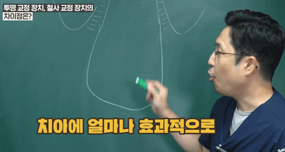 치아교정기간이 부담될 때, 미니쉬교정이 답이 되는 경우는 따로 있습니다. 관련 이미지 5