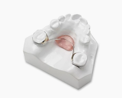 소아치아교정, 지금 시작해야 할까요? 관련 이미지 5