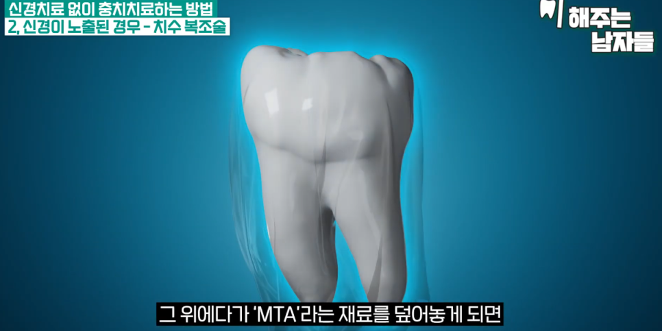 신당역치과 충치치료 시 신경치료는 필수일까? 관련 이미지 6