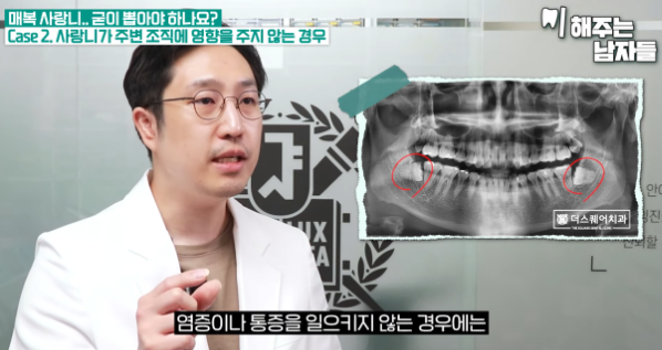 이대치과 매복사랑니, 꼭 발치해야 될까요 관련 이미지 8