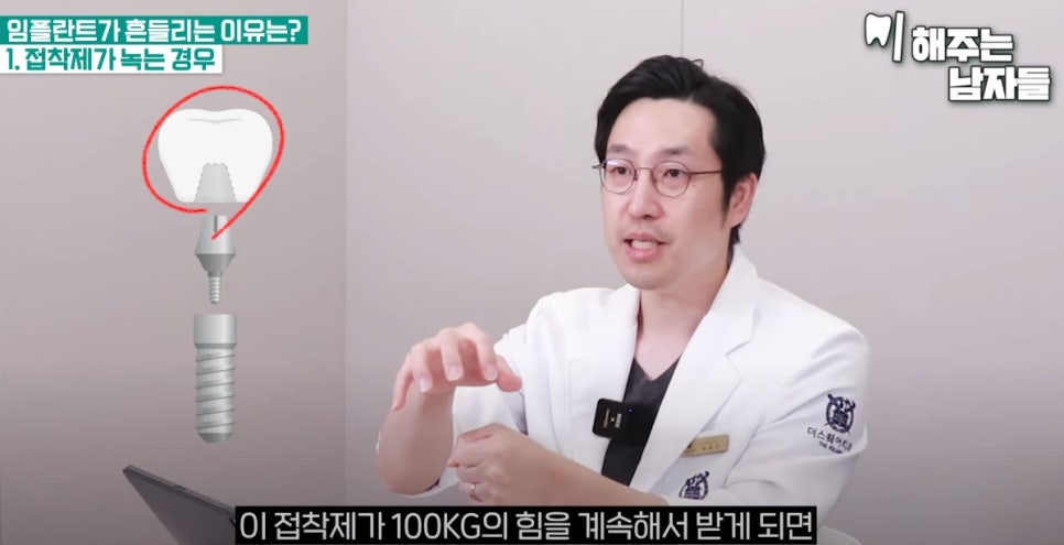 충정로치과, 임플란트가 흔들리는 이유는? 관련 이미지 4