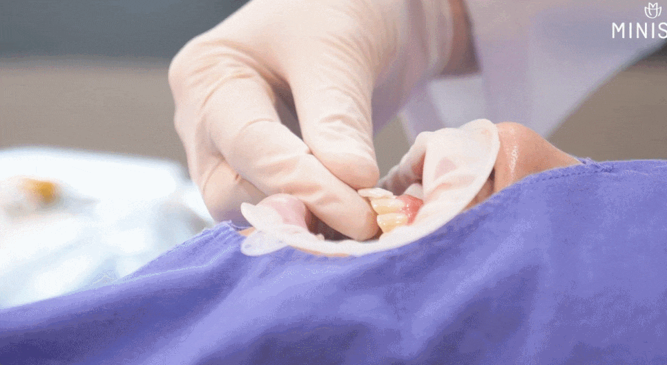 미니쉬치과의원 선택 전, 이 기준은 확인하셨나요? 관련 이미지 3