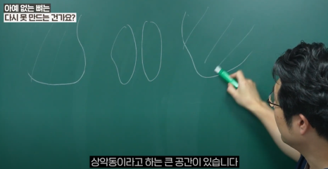 광화문 임플란트 할 때, 뼈이식이 필요한 이유 관련 이미지 5