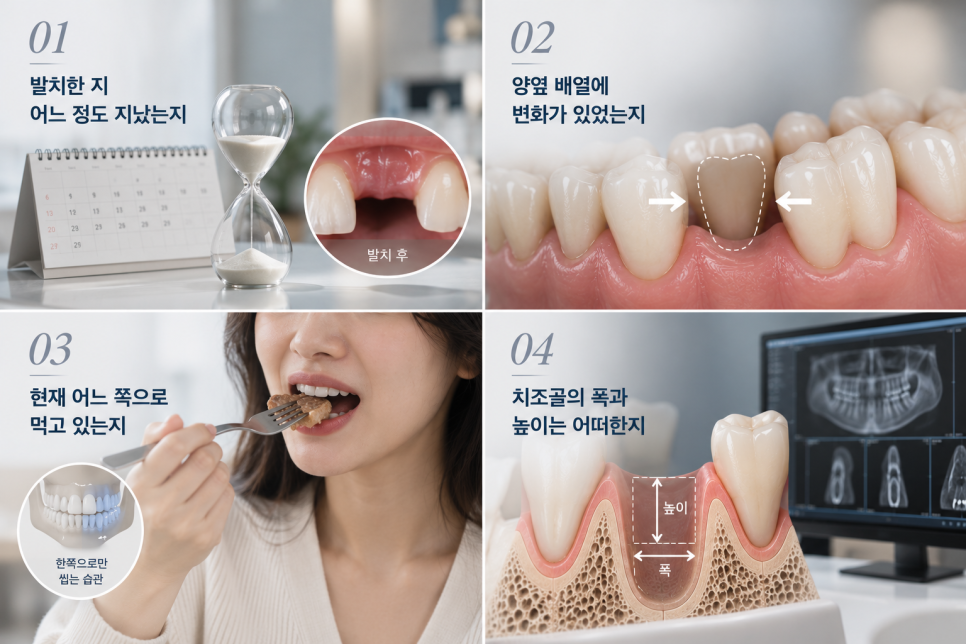 30대 임플란트, 나이보다 중요한 것은? 광화문 치과 상담 가이드 관련 이미지 8