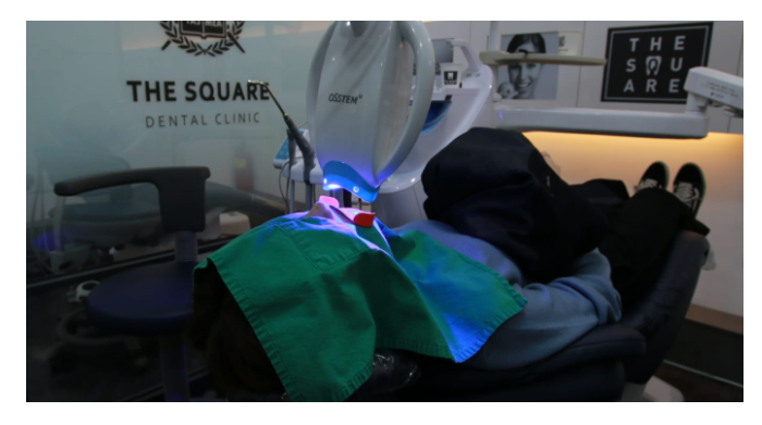 치아미백 효과? 누구나 같은 결과가 나오는 건 아닙니다. 관련 이미지 6