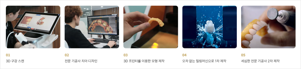 덧니 라미네이트 VS 덧니치아교정, 이 글로 고민 끝내드립니다 관련 이미지 16
