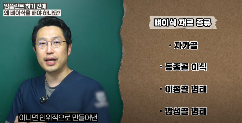 광화문 임플란트 할 때, 뼈이식이 필요한 이유 관련 이미지 4