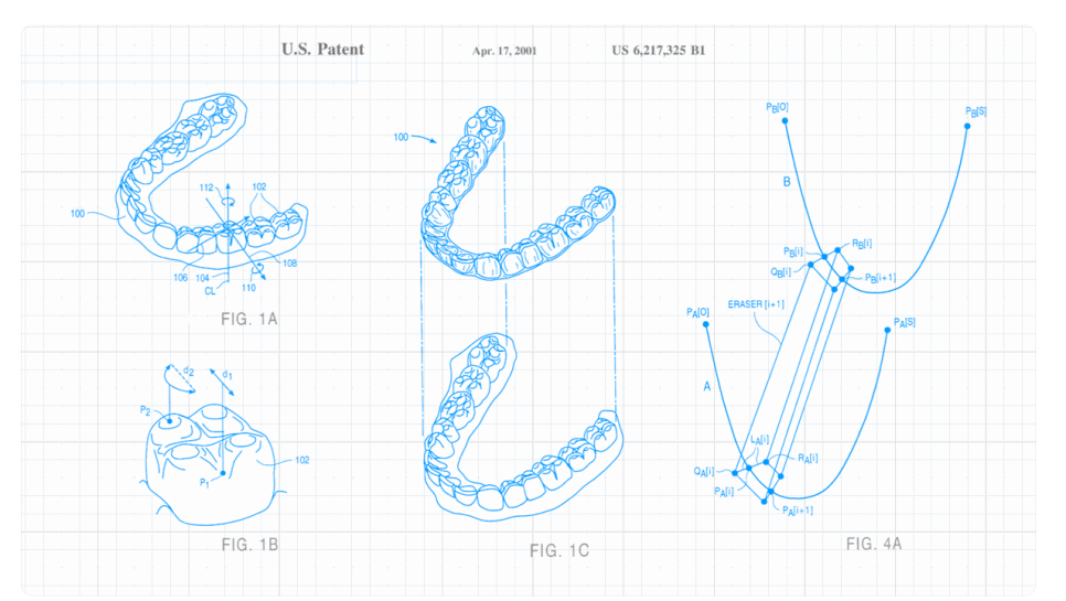 주걱턱교정, 정말 수술만 답일까요? 기준은 따로 있습니다. 관련 이미지 3