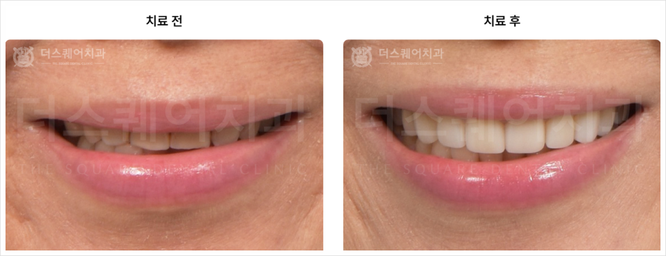 미니쉬치과의원 선택 시 이 관련 이미지 9