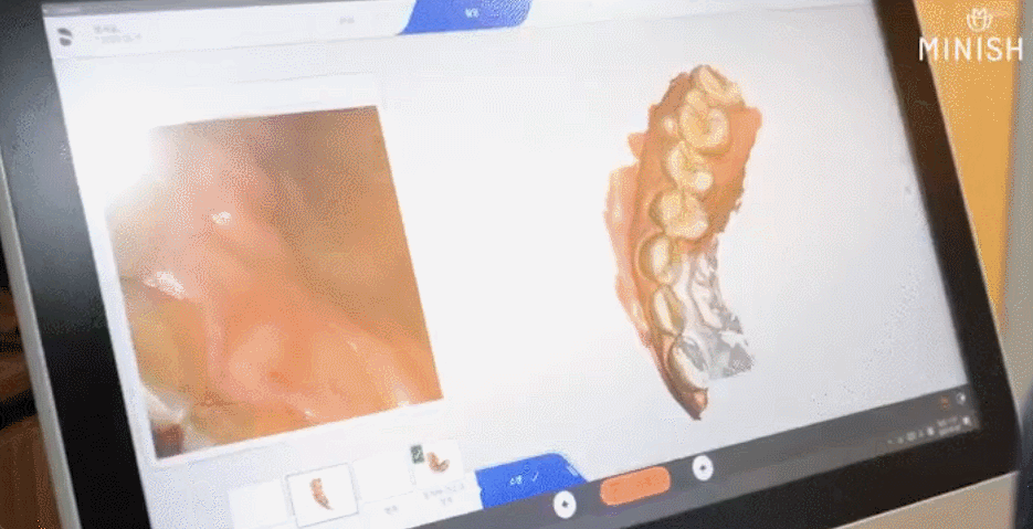 앞니미니쉬, 시림·관리·교체주기 한 번에 정리합니다. 관련 이미지 3