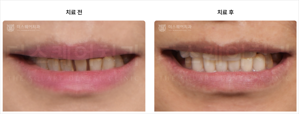 미니쉬치과의원 선택 시 이 관련 이미지 11