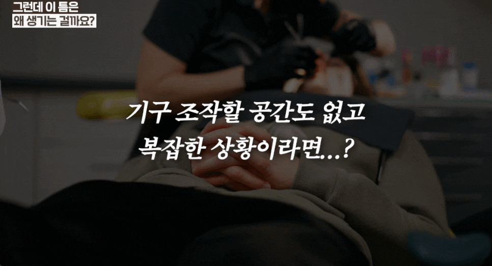 앞니 블랙트라이앵글 치료 : 레진 VS 비니어큐브 VS 교정 가이드 관련 이미지 9