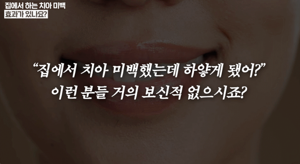 연예인치아미백, 치아 변색 이유부터 알아야 제대로 효과 봅니다 관련 이미지 9