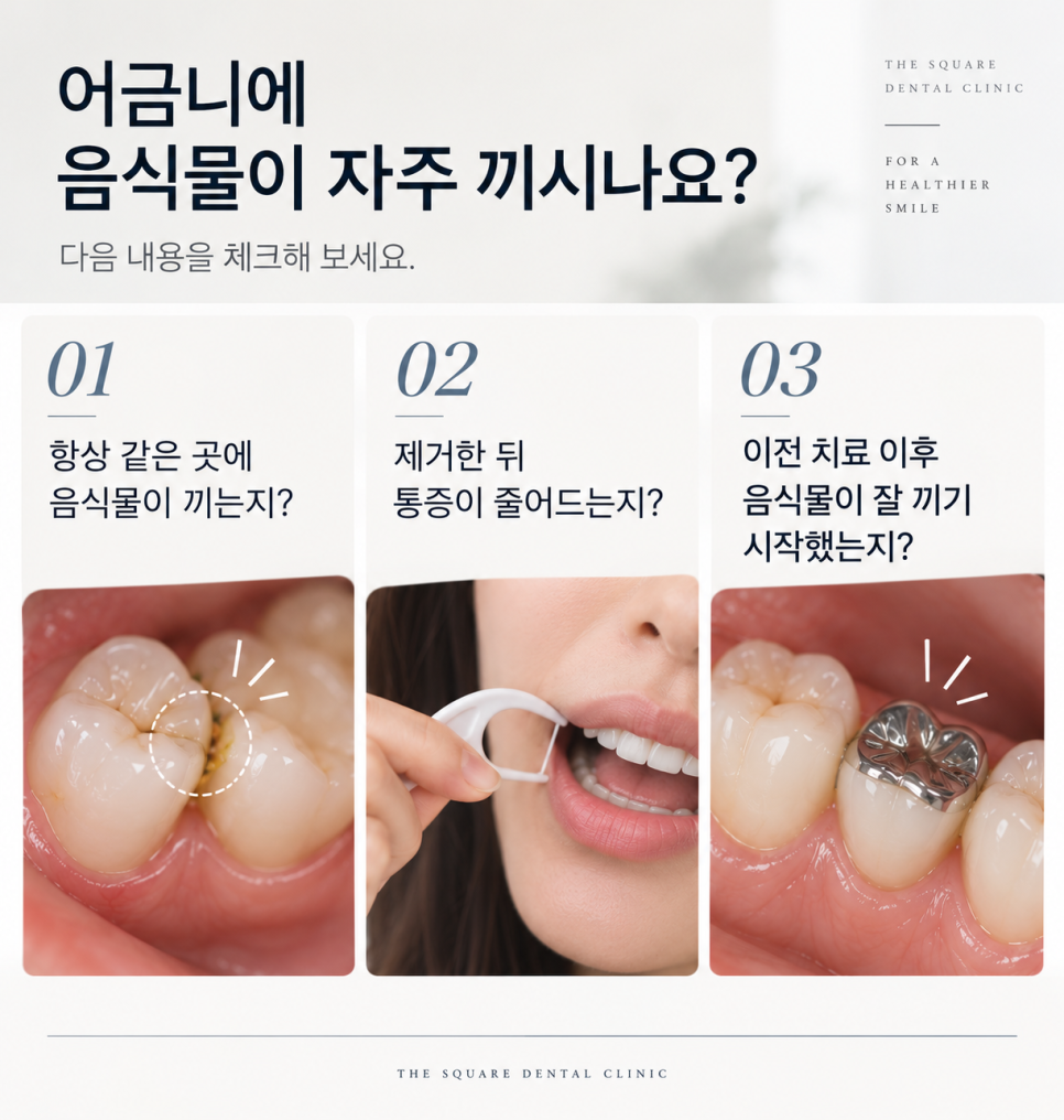 어금니잇몸통증, 잇몸이 욱신거린다면 확인할 3가지 관련 이미지 10