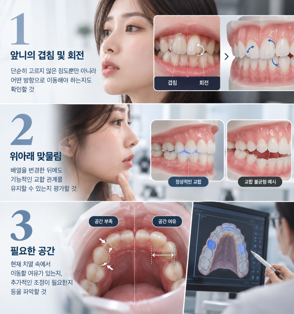 성인 치아 교정, 비용보다 먼저 살펴볼 조건 관련 이미지 8