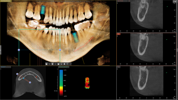 [숭실대학교입구역] 서울일 요일치과 믿을수있는치과 리더스진치과 입니다^^ 관련 이미지 2