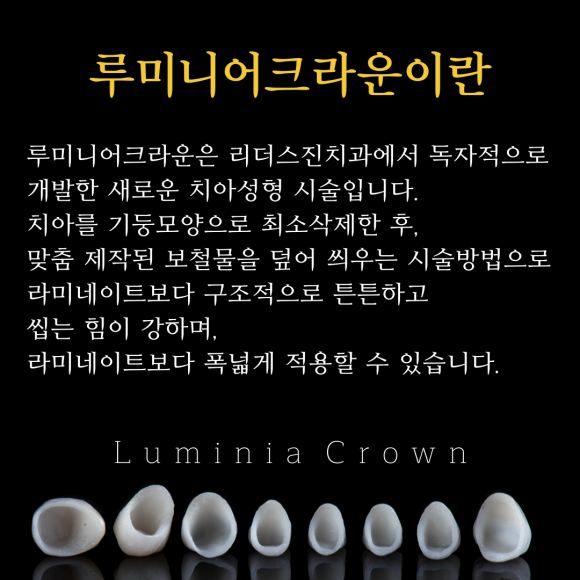 나이 상관없이 환하게 웃고싶다면? 붙이지 않고 씌우는 치아성형 관련 이미지 2