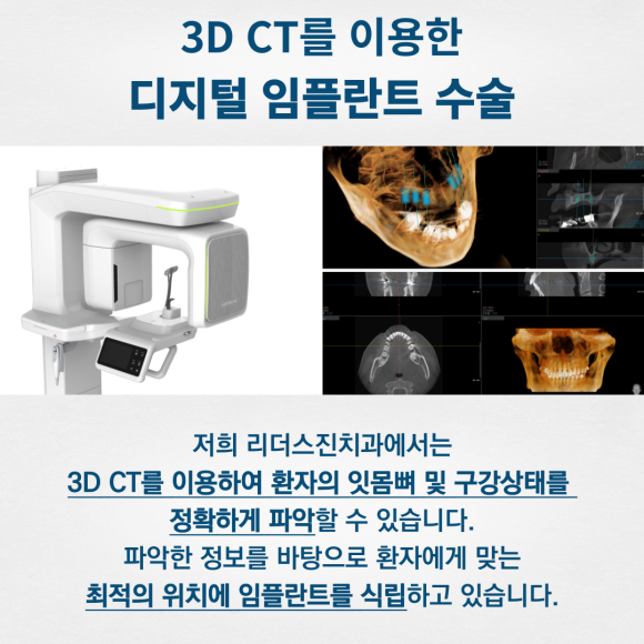 상도동치과, 진단부터 수술 후 관리까지 대표원장이 직접 책임지는 리더스진치과 관련 이미지 2