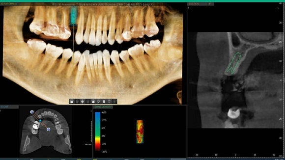 [숭실대학교입구역] 서울일 요일치과 믿을수있는치과 리더스진치과 입니다^^ 관련 이미지 3