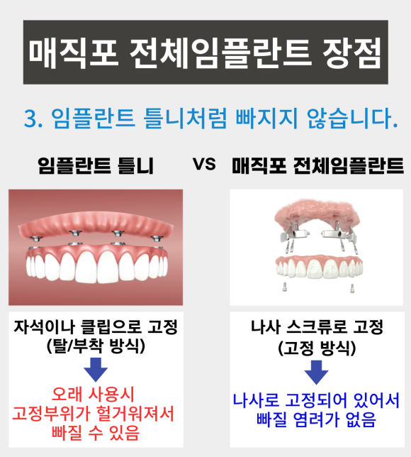 무치악환자들이 추천하는 매직포 전체임플란트 장점, <전체임플란트 중점치과 리더스진치과> 관련 이미지 4