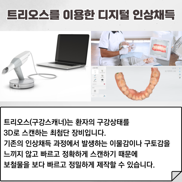 "디지털 진료 시스템"으로 빠르고 정확하게 진료하는 리더스진치과 관련 이미지 5