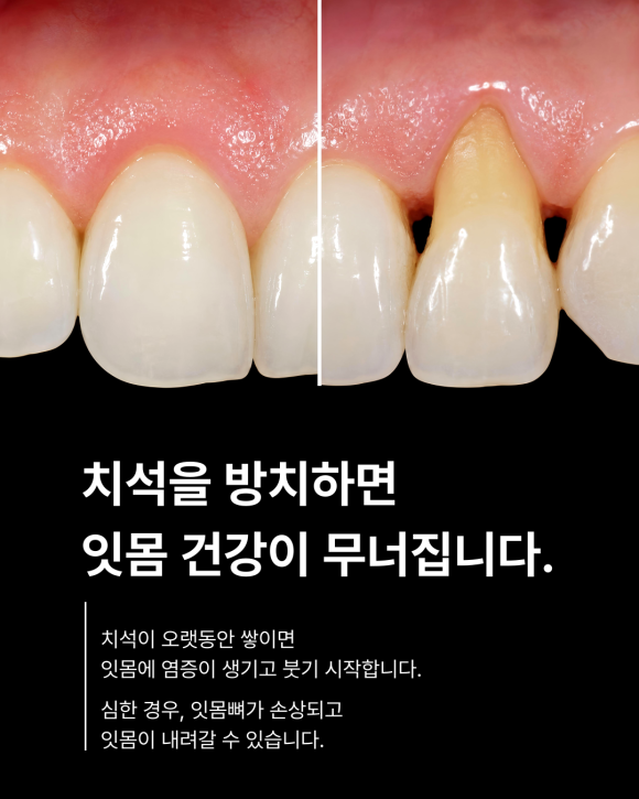 스케일링, 선택이 아닌 필수입니다. 관련 이미지 3