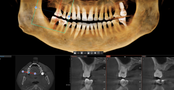 정확한 진단으로, 치료의 결과까지 책임지는 치과 관련 이미지 3