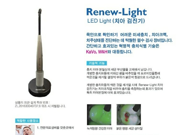 [숭실대 입구역] [리더스진 치과] - 병원마다 다른 충치갯수, 왜 다른가? 를 사진과 함께 리더스진 치과에서 종결시켜 드리겠습니다. 관련 이미지 2