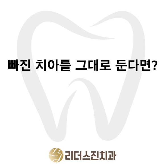 빠진 치아 그대로 방치하면 어떻게 될까요?? [상도동 리더스진치과] 관련 이미지 1