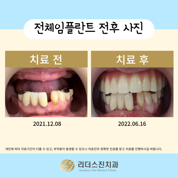 상도동 리더스진치과, 취약계층 의료지원사업 <첫번째 이야기> 관련 이미지 4