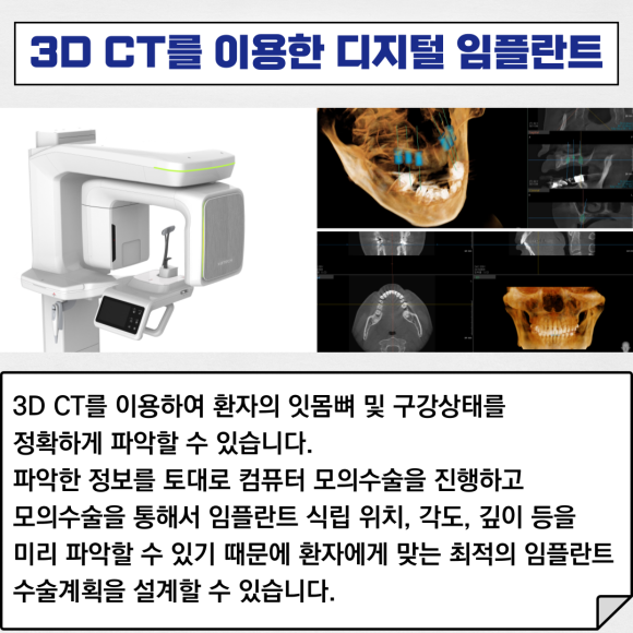 "디지털 진료 시스템"으로 빠르고 정확하게 진료하는 리더스진치과 관련 이미지 4