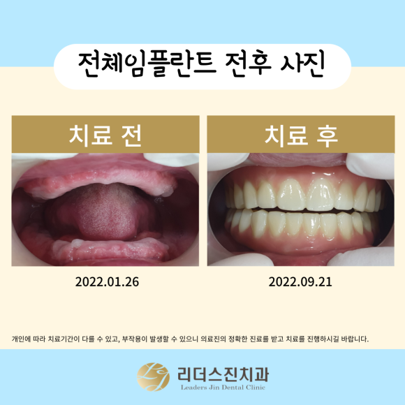 상도동 리더스진치과, 취약계층 의료지원사업 <두번째 이야기> 관련 이미지 5