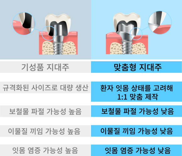 맞춤형 지대주를 이용한 1:1 맞춤 임플란트 <전체임플란트 중점치과 리더스진치과> 관련 이미지 4