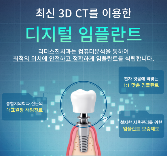 "디지털 진료 시스템"으로 빠르고 정확하게 진료하는 리더스진치과 관련 이미지 7