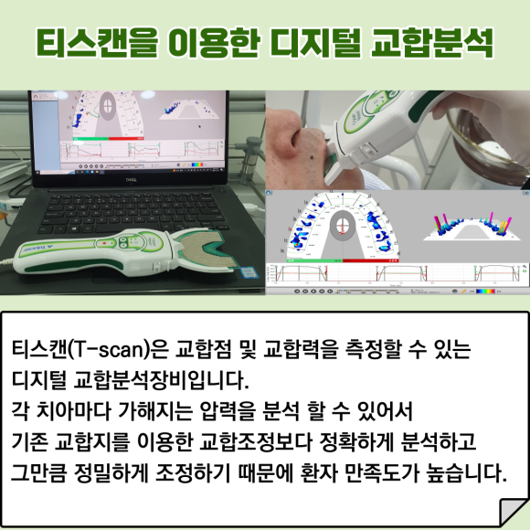 "디지털 진료 시스템"으로 빠르고 정확하게 진료하는 리더스진치과 관련 이미지 6