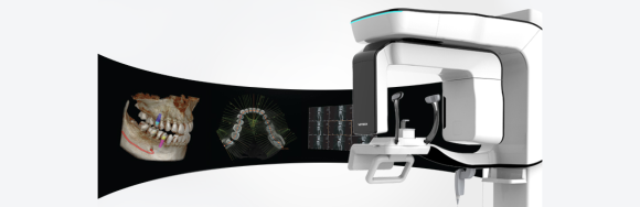 디지털 치과, 리더스진 치과의 특별한 진단 과정을 공개합니다. 관련 이미지 8