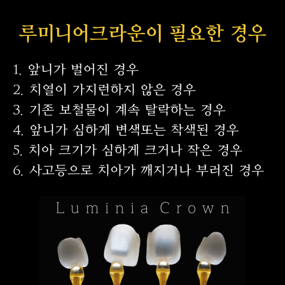 나이 상관없이 환하게 웃고싶다면? 붙이지 않고 씌우는 치아성형 관련 이미지 3