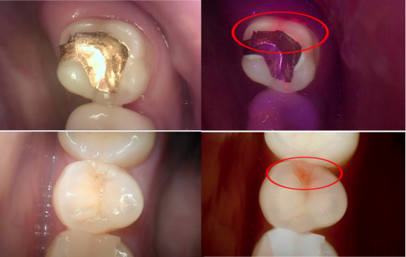 정확한 진단으로, 치료의 결과까지 책임지는 치과 관련 이미지 1