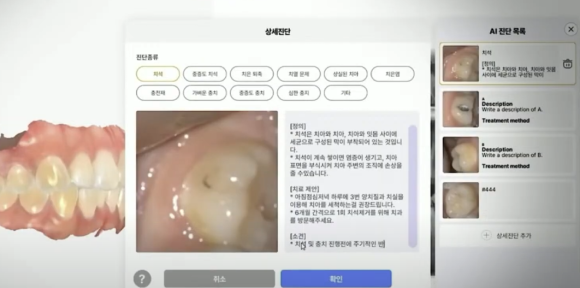 디지털 치과, 리더스진 치과의 특별한 진단 과정을 공개합니다. 관련 이미지 14