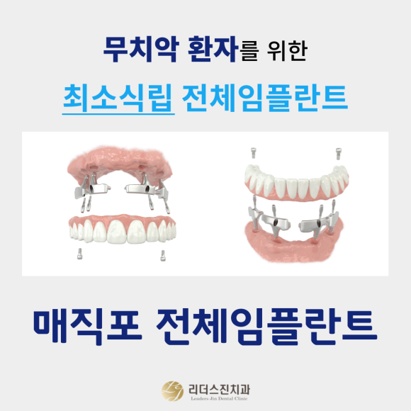 자꾸 빠지는 불편한 틀니 "매직포 전체임플란트"로 해결하세요~!! 관련 이미지 1