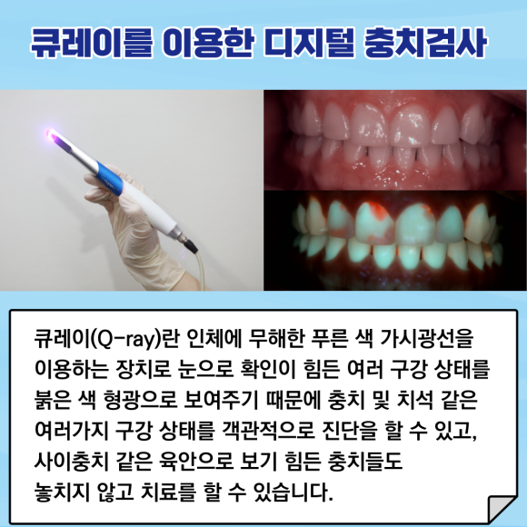 "디지털 진료 시스템"으로 빠르고 정확하게 진료하는 리더스진치과 관련 이미지 3