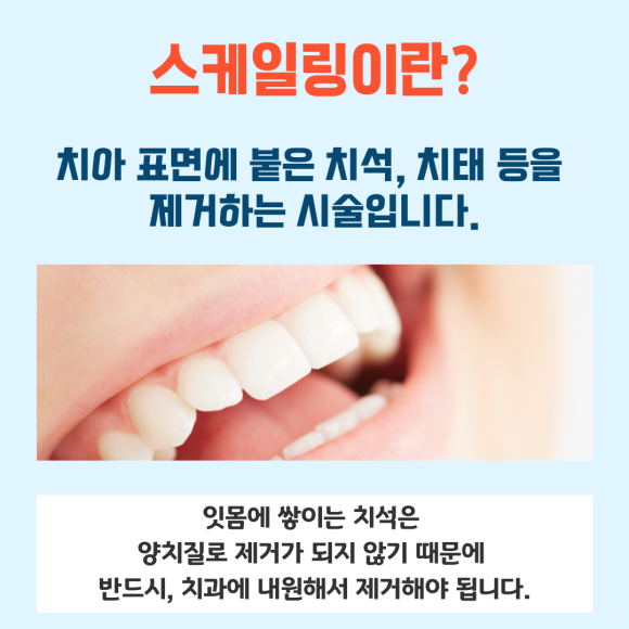 뇌졸증 치매 심혈관질환 당뇨를 예방하는 스케일링! 관련 이미지 4