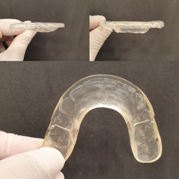 잠잘 때 이갈이 하시나요? 이갈이 마우스피스의 중요성 관련 이미지 6