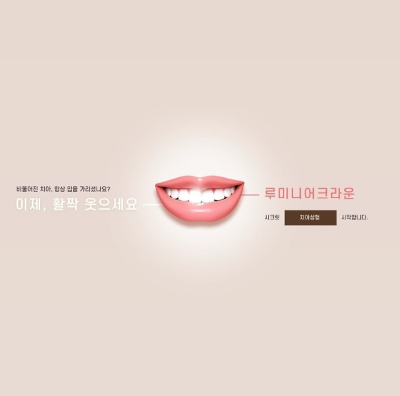 [숭실대입구역] [심미보철] 리더스진치과 심미보철 연예인보철 인플루언서치과 앞니성형 루미니어크라운 관련 이미지 1