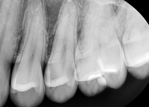 정확한 진단으로, 치료의 결과까지 책임지는 치과 관련 이미지 2