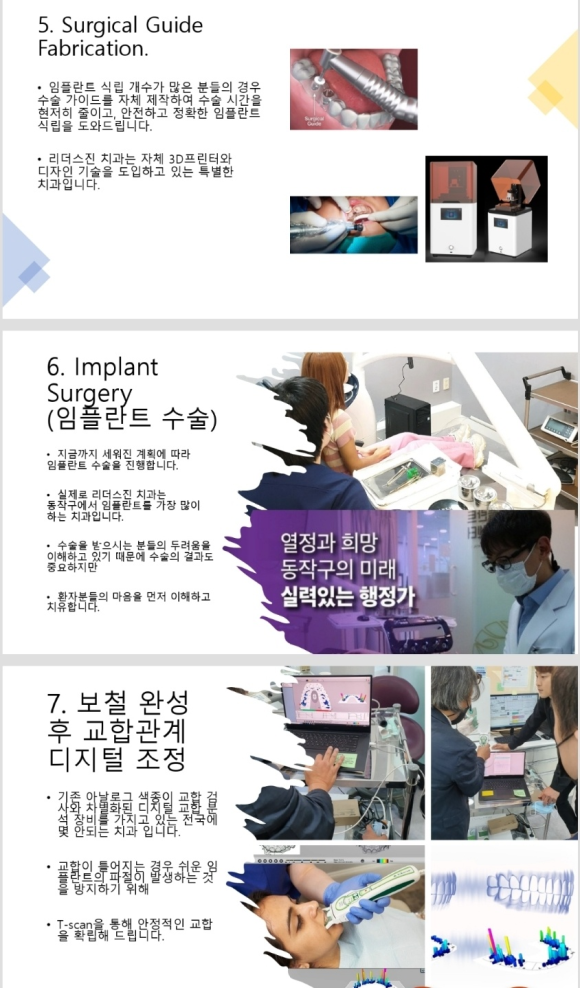 <<<<리더스진 치과의 임플란트 프로토콜 >>> 관련 이미지 3