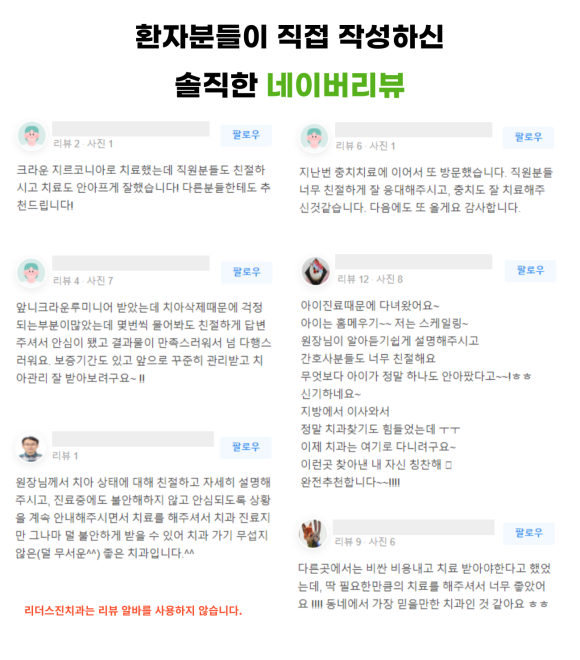 앞니깨짐, 루미니어크라운으로 깨진앞니 바로 치료하는 이유 관련 이미지 4
