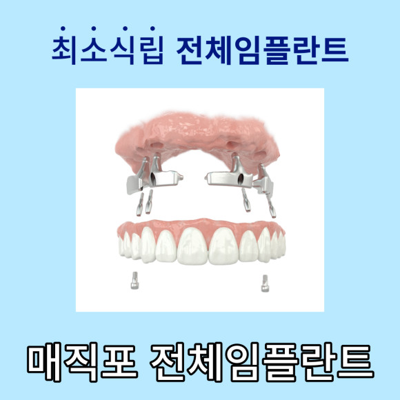 [상도동 치과] 전체임플란트 어디서 할지 고민이신가요?? 관련 이미지 2