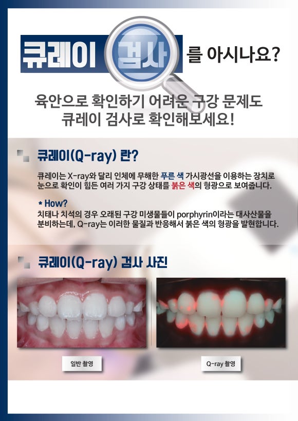 충치검사, "큐레이"로 좀 더 정확하게 진단합니다. <리더스진치과> 관련 이미지 3