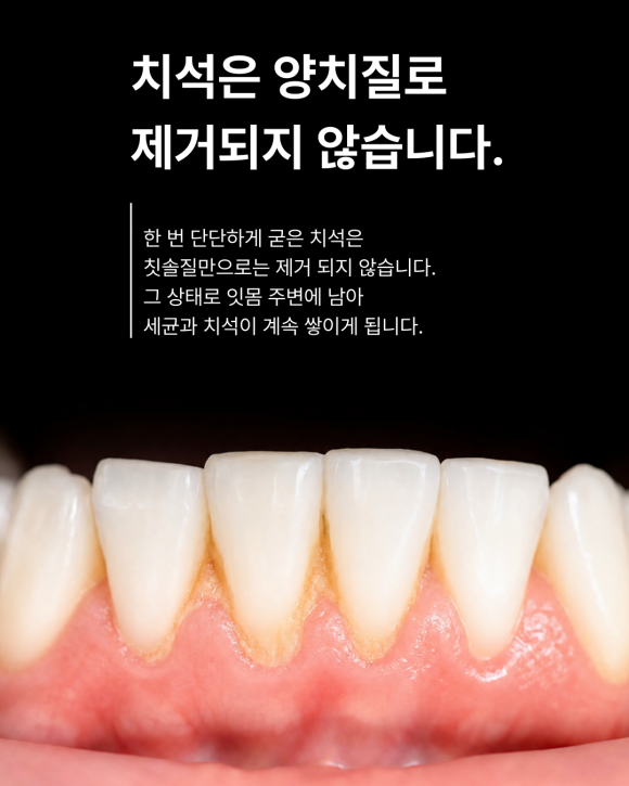 스케일링, 선택이 아닌 필수입니다. 관련 이미지 2